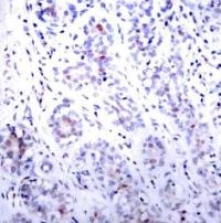 STAT3 Antibody