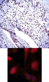 STAT3 Antibody
