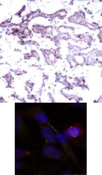 ELK1 Antibody