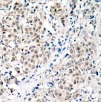 MYC Antibody