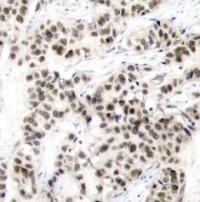MYC Antibody