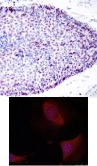 ATF2 Antibody