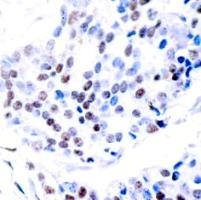 JUN Antibody