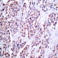 NFKB2 Antibody