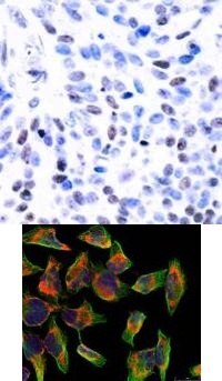 NFKB2 Antibody