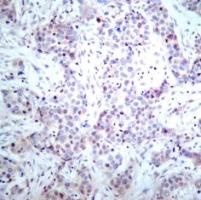RELA Antibody