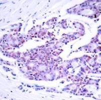 RELA Antibody