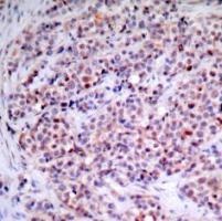RELA Antibody