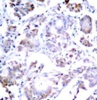 RELA Antibody