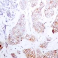 RAF1 Antibody
