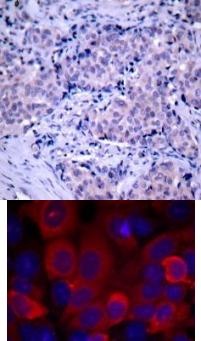 PDK1 (Ab 241) Antibody
