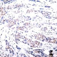 ELK1 Antibody