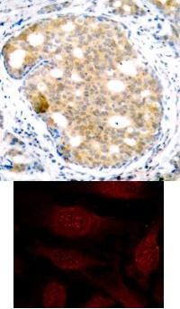 GSK3B Antibody