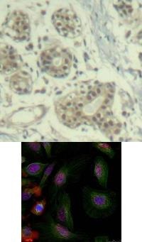 MDM2 Antibody
