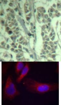 CBL Antibody