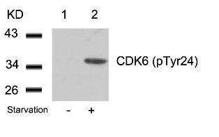 CDK6 Antibody