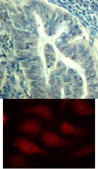 CDK6 Antibody