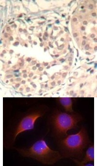 CDK6 Antibody
