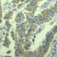 MARCKS Antibody