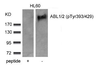 ABL1 / 2 (phospho Tyr393 / Tyr429) Antibody