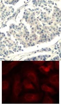 ABL1 / 2 (phospho Tyr393 / Tyr429) Antibody