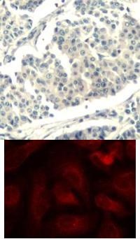 ABL1 ABL2 Antibody