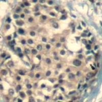 HDAC4 / HDAC5 / HDAC9 (phospho Ser246 / Ser259 / Ser220) Antibody