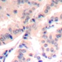 eIF4B (phospho Ser422) Antibody