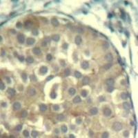 CFL1 CFL2 Antibody