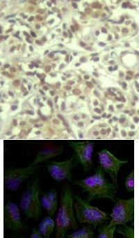 AKT1 Antibody