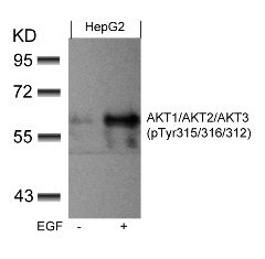 AKT1 AKT2 AKT3 Antibody