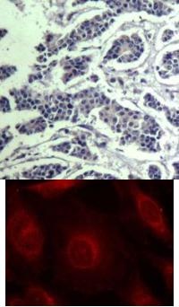 AKT1 AKT2 AKT3 Antibody