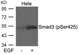 Smad3 (phospho Ser425) Antibody