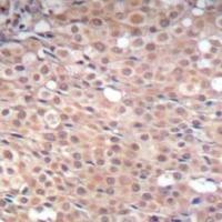 Smad3 (phospho Ser425) Antibody