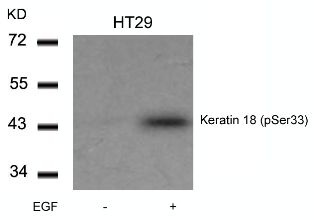 KRT18 Antibody