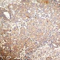 KRT18 Antibody