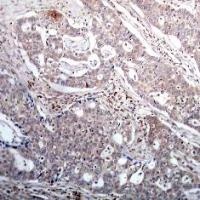 NFKBIB Antibody