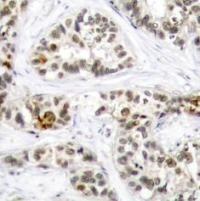 RelB (phospho Ser573) Antibody