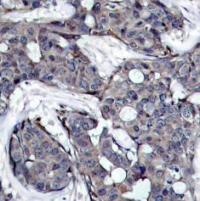 HSPB1 Antibody