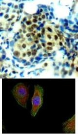 p44 / 42 MAP Kinase (phospho Thr202) Antibody