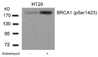 BRCA1 Antibody