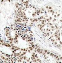 BRCA1 Antibody