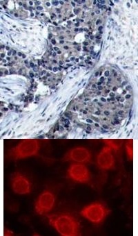 eIF4E (phospho Ser209) Antibody