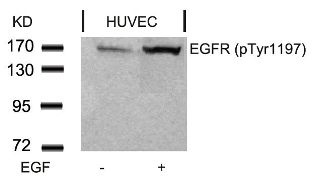 EGFR Antibody