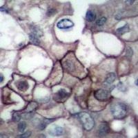 EGFR Antibody