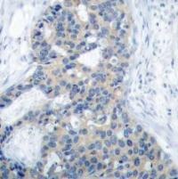 Stathmin 1 (phospho Ser38) Antibody