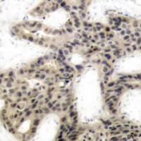 EIF4EBP1 Antibody