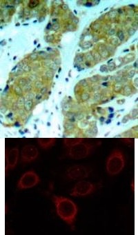 mTOR (phospho Ser2448) Antibody