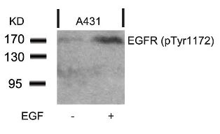 EGFR Antibody
