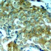EGFR Antibody